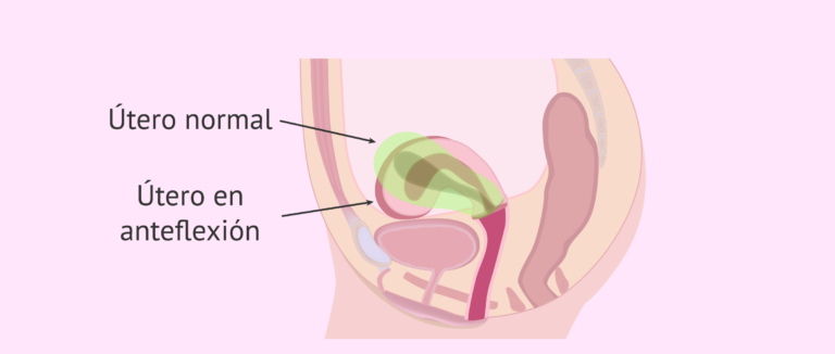 Anteflexión del útero: todo sobre su anatomía y causas