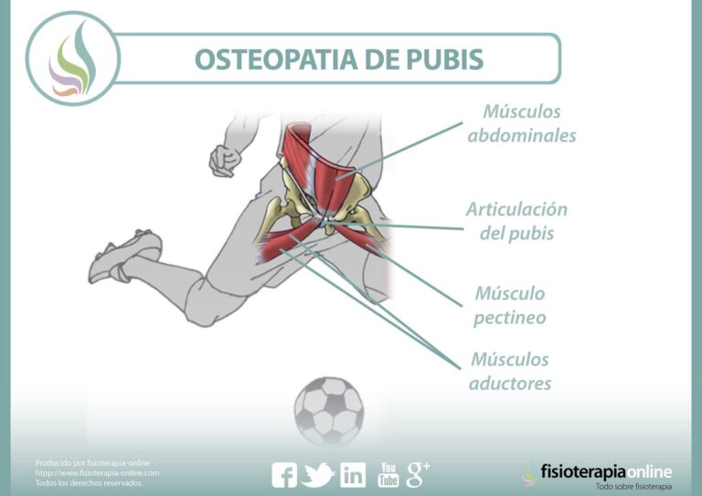 Cirugía de osteopatía de pubis: proceso y recuperación