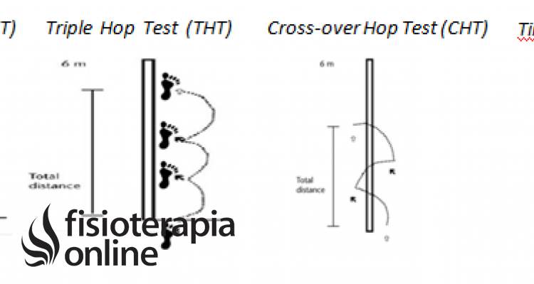 Descubre los Hop Test: la herramienta clave para evaluar tu rendimiento físico