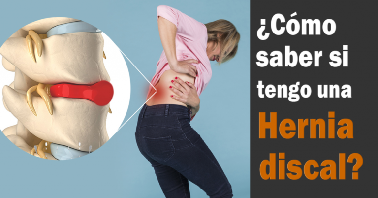 Descubre si tienes una hernia discal o lesión en tu espalda baja
