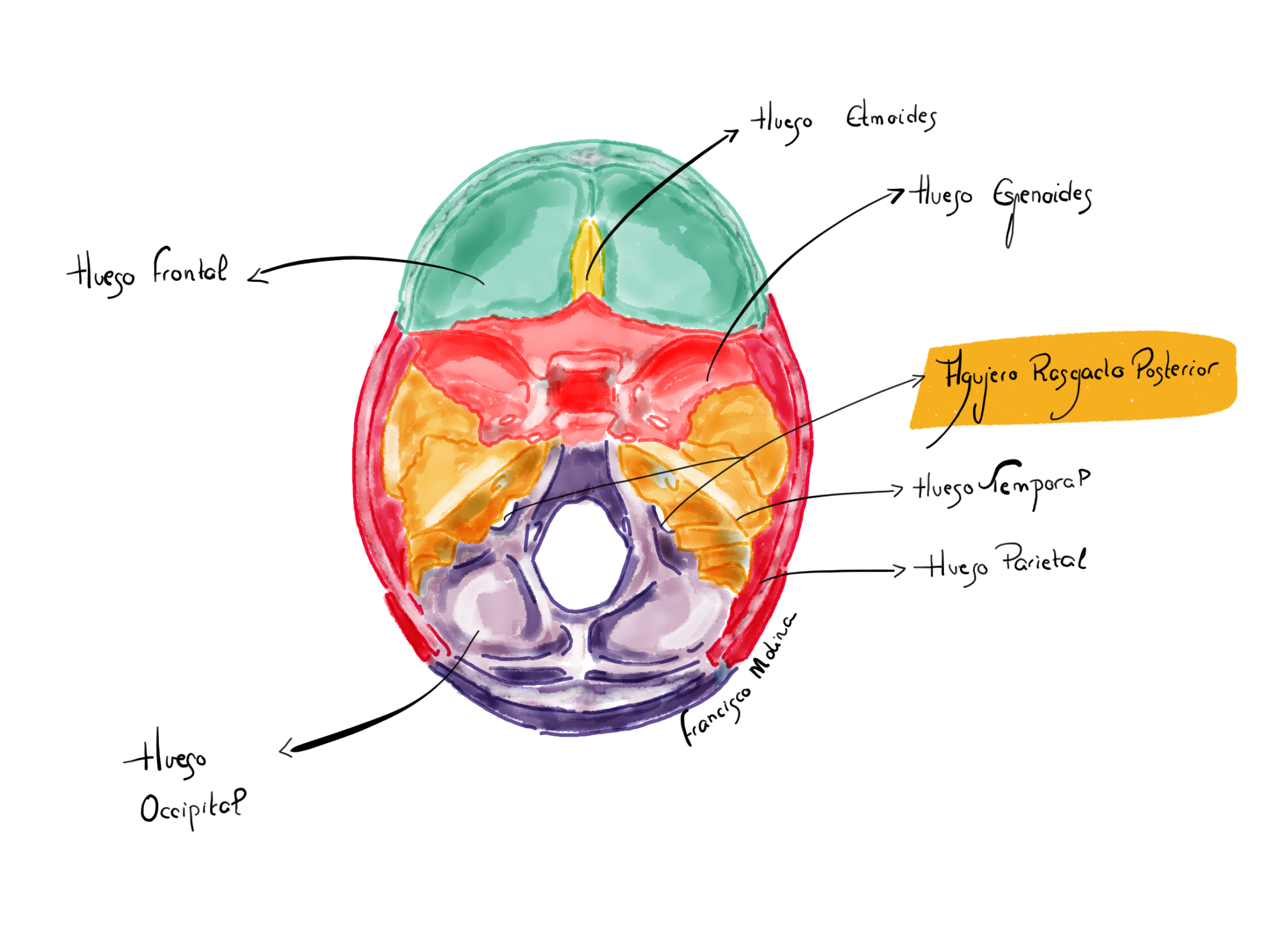 Formane Rasgado Foramen Yugular: Anatomía Microquirúrgica y Abordajes