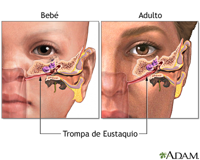 Patología de la Trompa de Eustaquio: Todo lo que necesitas saber