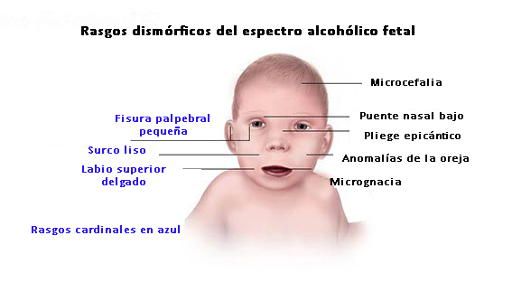 Síndromes frontales: Los cambios en el niño que conmueven a los padres